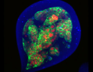 Microscopie Confocale Et Spinning Disk Optoprim